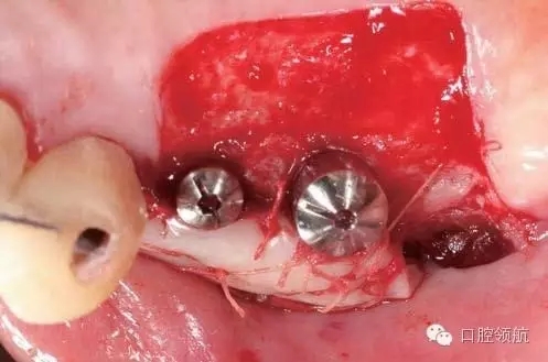 640.webp (4).jpg 640.webp (4).jpg