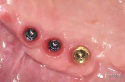 640.webp (6).jpg 640.webp (6).jpg