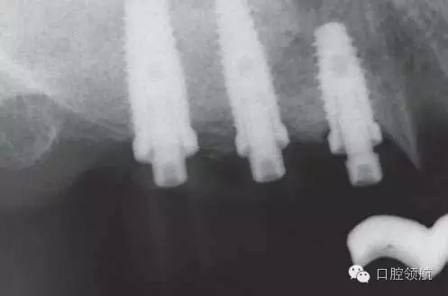 640.webp (7).jpg 640.webp (7).jpg