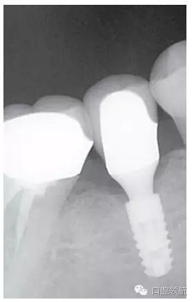 640.webp (3).jpg 640.webp (3).jpg