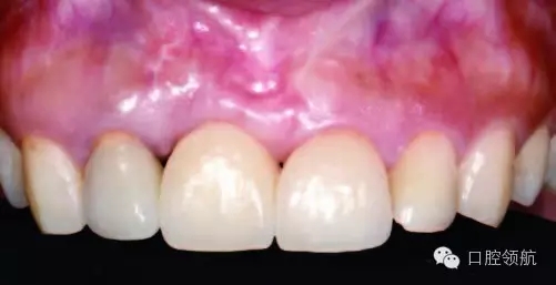 640.webp (9).jpg 640.webp (9).jpg