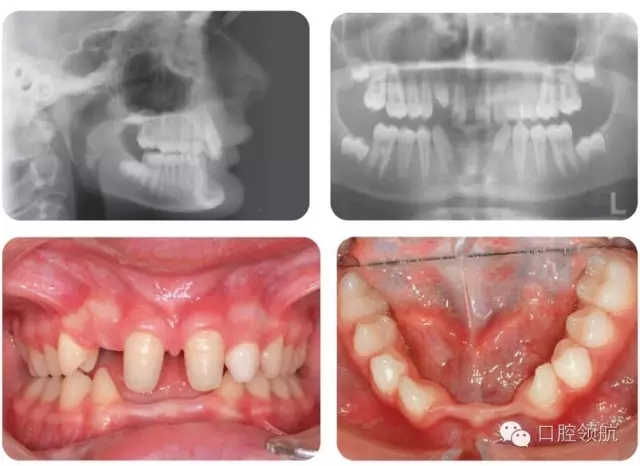 640.webp (1).jpg 640.webp (1).jpg