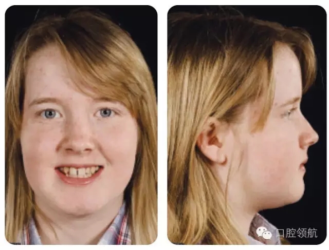 640.webp (2).jpg 640.webp (2).jpg