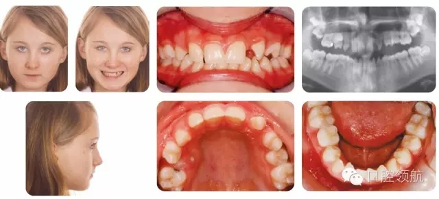 640.webp.jpg 640.webp.jpg