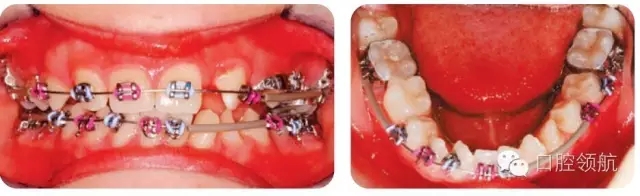 640.webp (1).jpg 640.webp (1).jpg