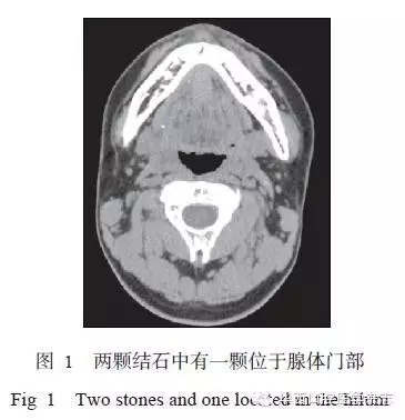 640.webp.jpg 640.webp.jpg