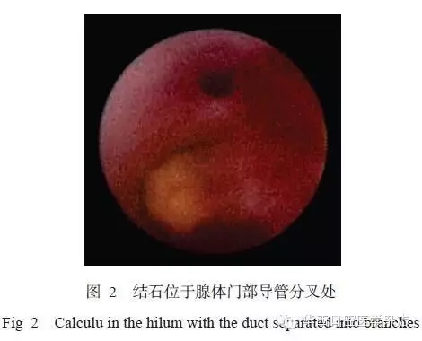 640.webp (1).jpg 640.webp (1).jpg