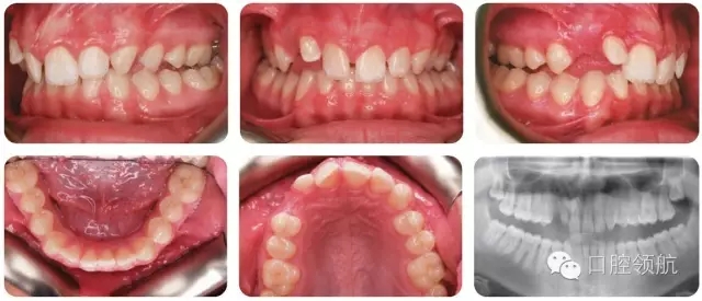 640.webp.jpg 640.webp.jpg