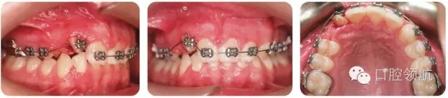 640.webp (3).jpg 640.webp (3).jpg