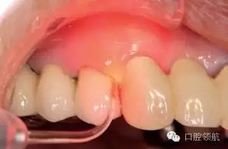 640.webp (4).jpg 640.webp (4).jpg