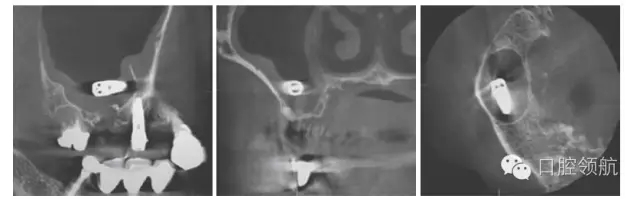 640.webp (1).jpg 640.webp (1).jpg