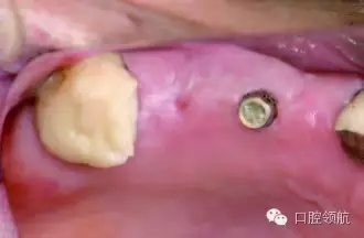 640.webp (3).jpg 640.webp (3).jpg