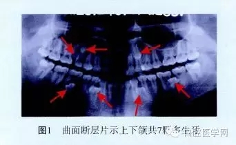 640.webp.jpg 640.webp.jpg