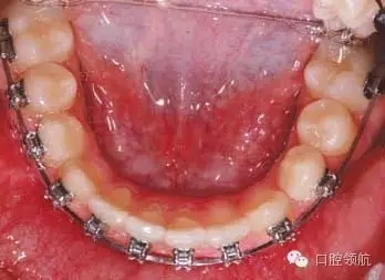 640.webp (2).jpg 640.webp (2).jpg