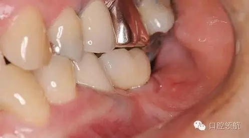 640.webp (3).jpg 640.webp (3).jpg