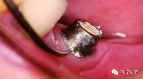 640.webp (5).jpg 640.webp (5).jpg