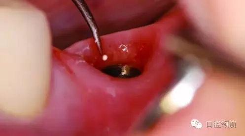 640.webp (7).jpg 640.webp (7).jpg