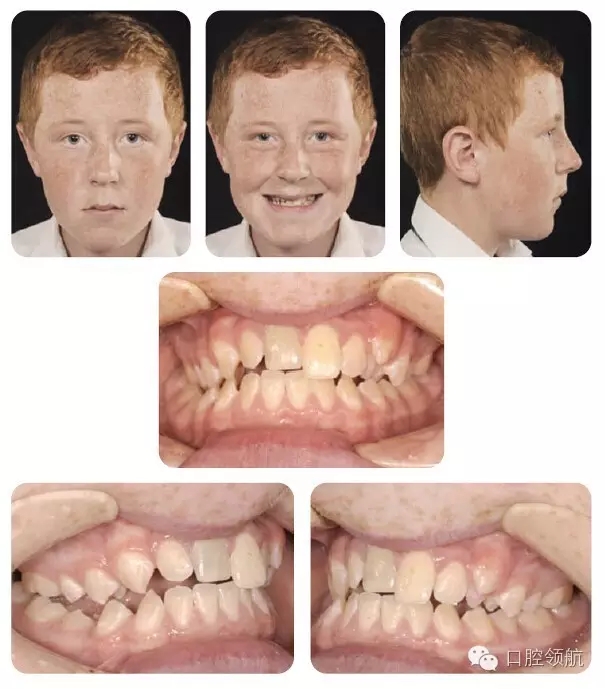 640.webp.jpg 640.webp.jpg