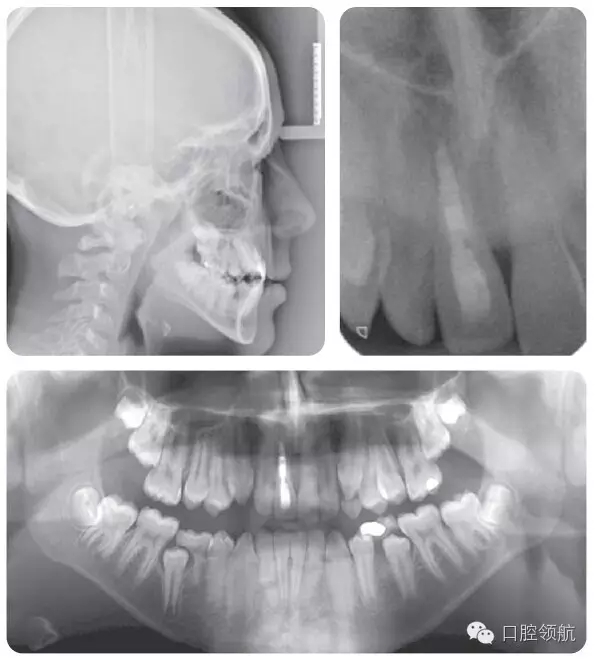 640.webp (1).jpg 640.webp (1).jpg