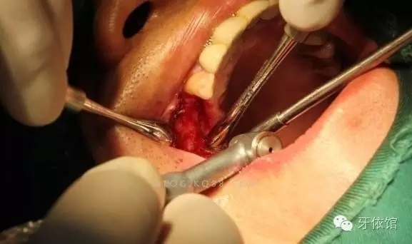 640.webp (2).jpg 640.webp (2).jpg