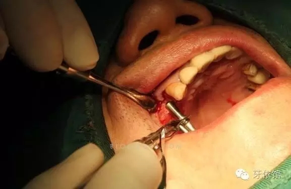 640.webp (8).jpg 640.webp (8).jpg