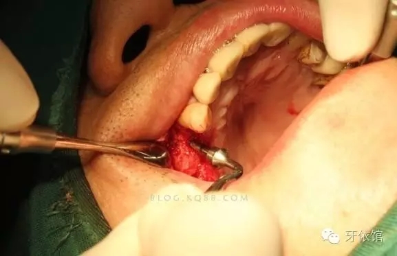 640.webp (10).jpg 640.webp (10).jpg