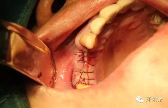 640.webp (20).jpg 640.webp (20).jpg