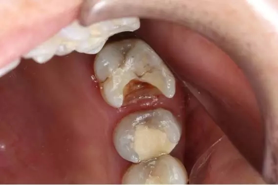 640.webp.jpg 640.webp.jpg