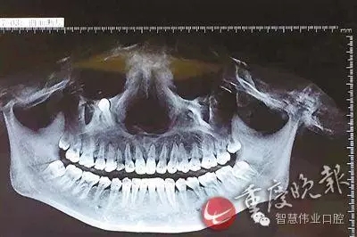 640.webp (2).jpg 640.webp (2).jpg