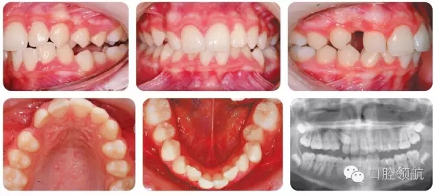 640.webp (3).jpg 640.webp (3).jpg