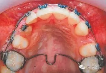 640.webp (5).jpg 640.webp (5).jpg