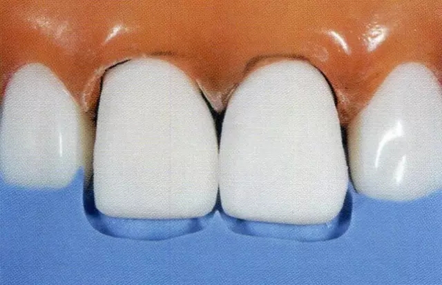 640.webp (5).jpg 640.webp (5).jpg