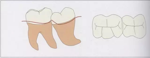 640.webp (1).jpg 640.webp (1).jpg