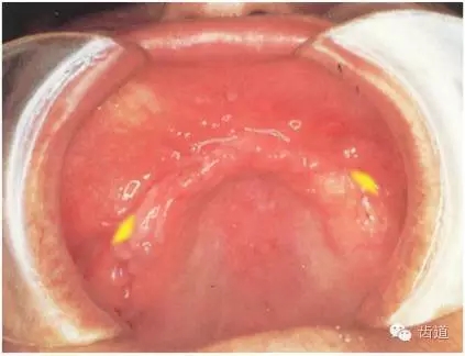 640.webp (7).jpg 640.webp (7).jpg