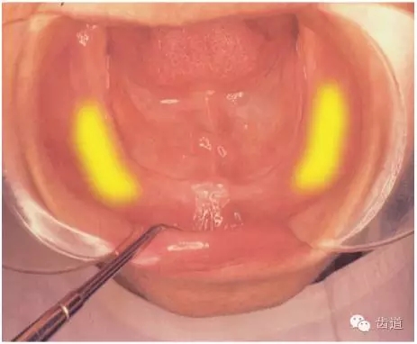 640.webp (10).jpg 640.webp (10).jpg