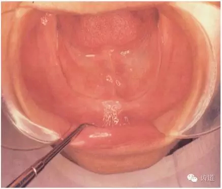 640.webp (11).jpg 640.webp (11).jpg