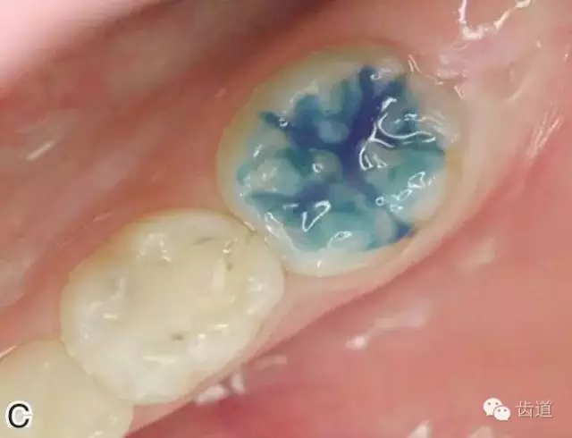 640.webp (2).jpg 640.webp (2).jpg