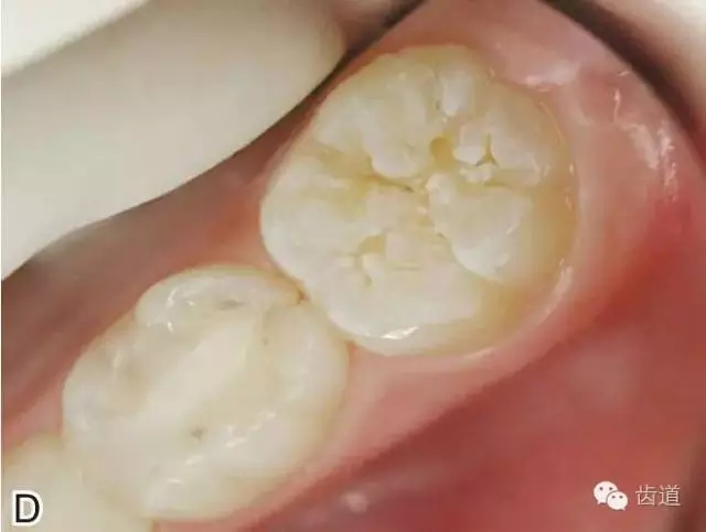 640.webp (3).jpg 640.webp (3).jpg