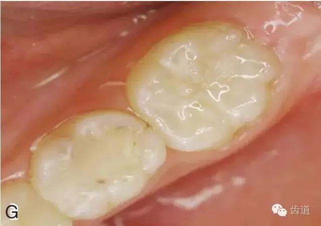 640.webp (6).jpg 640.webp (6).jpg