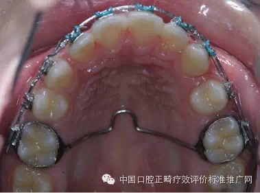 0.webp.jpg 0.webp.jpg