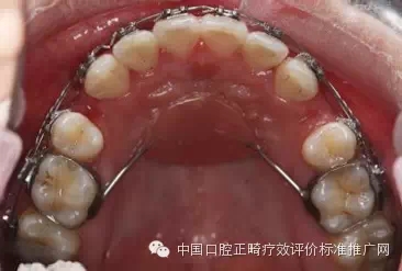 0.webp (1).jpg 0.webp (1).jpg