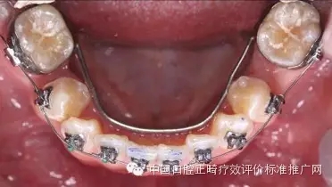 0.webp (2).jpg 0.webp (2).jpg