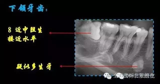 640.webp (3).jpg 640.webp (3).jpg