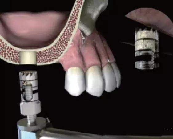 640.webp.jpg 640.webp.jpg