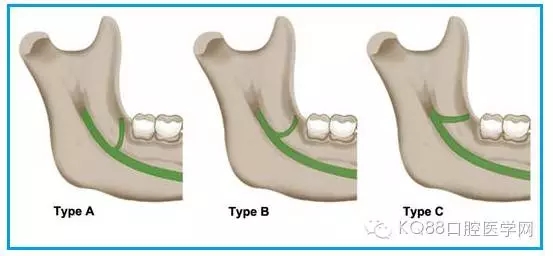 640.webp (2).jpg 640.webp (2).jpg