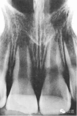 640.webp (8).jpg 640.webp (8).jpg