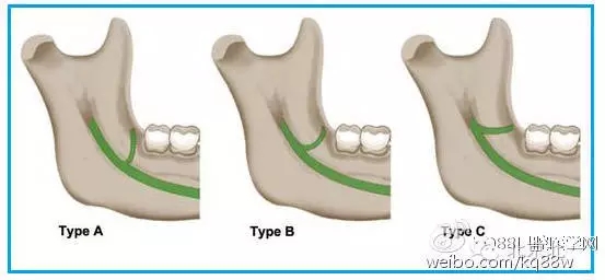 640.webp (2).jpg 640.webp (2).jpg