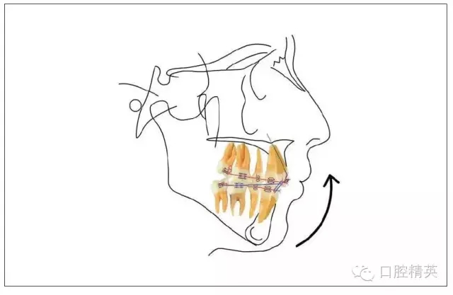 640.webp (1).jpg 640.webp (1).jpg