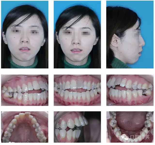 640.webp (3).jpg 640.webp (3).jpg