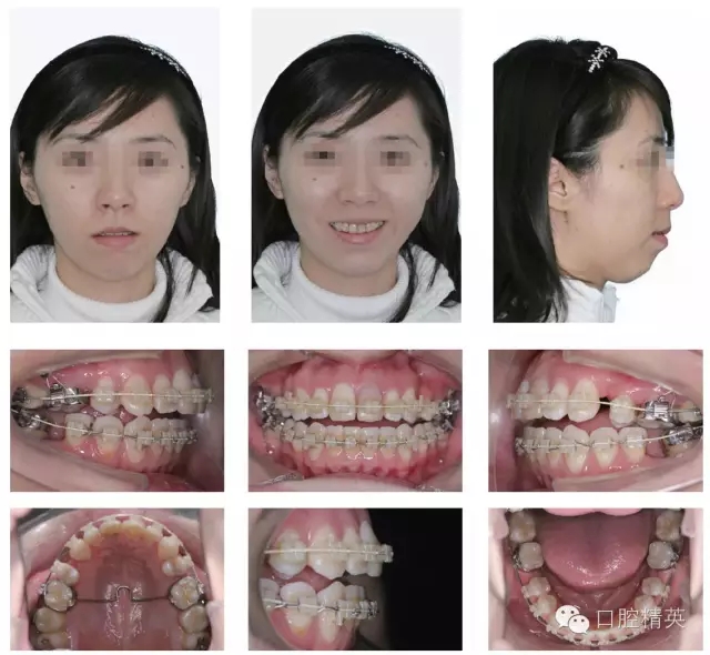 640.webp (6).jpg 640.webp (6).jpg